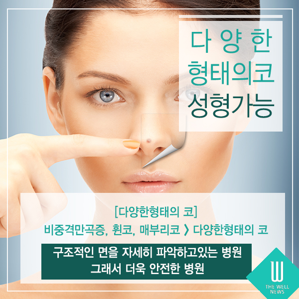 비염코성형 이비인후과 성형외과 협진의 장점은? (3/6)