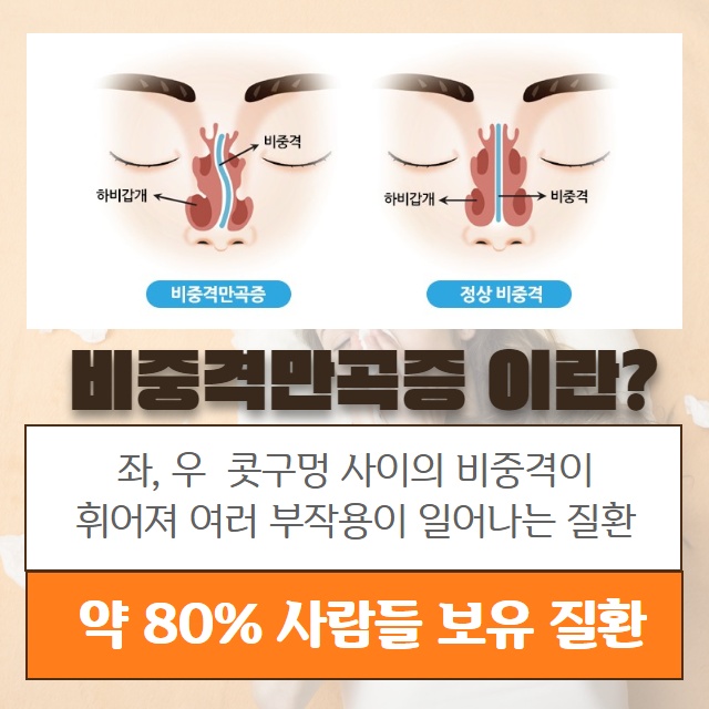 약물로는 치료 안되는 축농증(부비동염) 원인은 따로 있다!? (2/11)