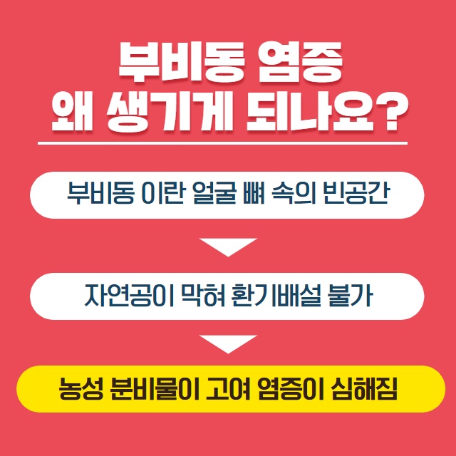 [수원이비인후과] 축농증(부비동염) 원인과 치료 방법! (5/15)