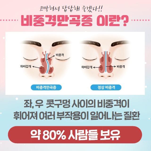 코막힘 원인 단순 감기일까? 코막힘 해결 방법! (2/9)