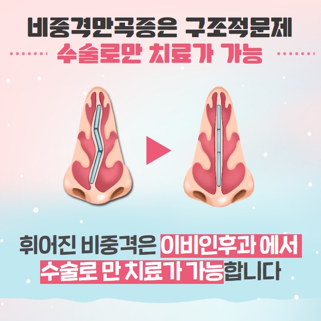코막힘 원인 단순 감기일까? 코막힘 해결 방법! (4/9)