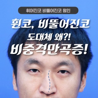 코가 휘어지고 비뚤어진 원인!