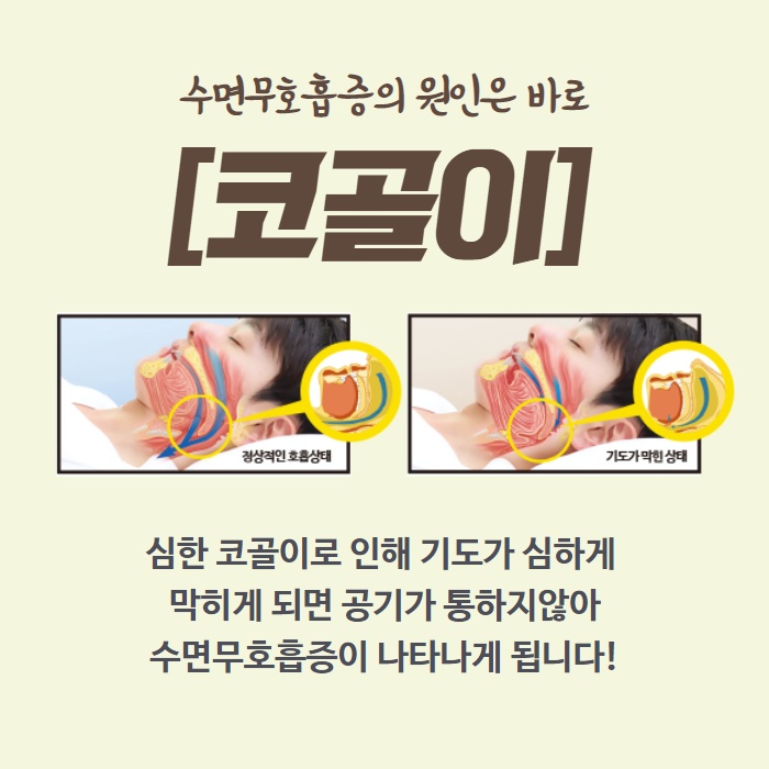 머리 아프고 낮 졸림 심할 때 수면 무호흡증 아닐까? (3/12)