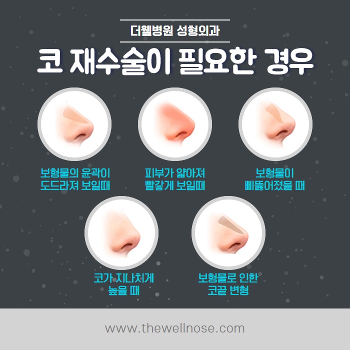 겨울에 코수술하면 딸기코 된다? (5/10)