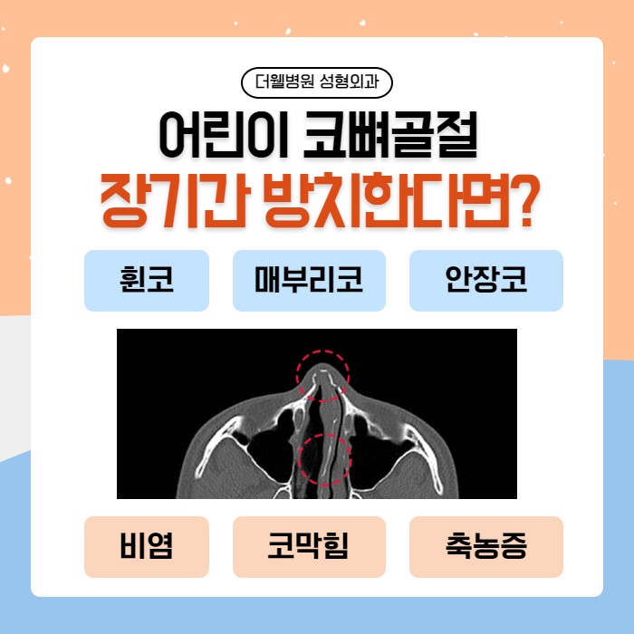 어린이 코뼈골절 치료 (3/10)
