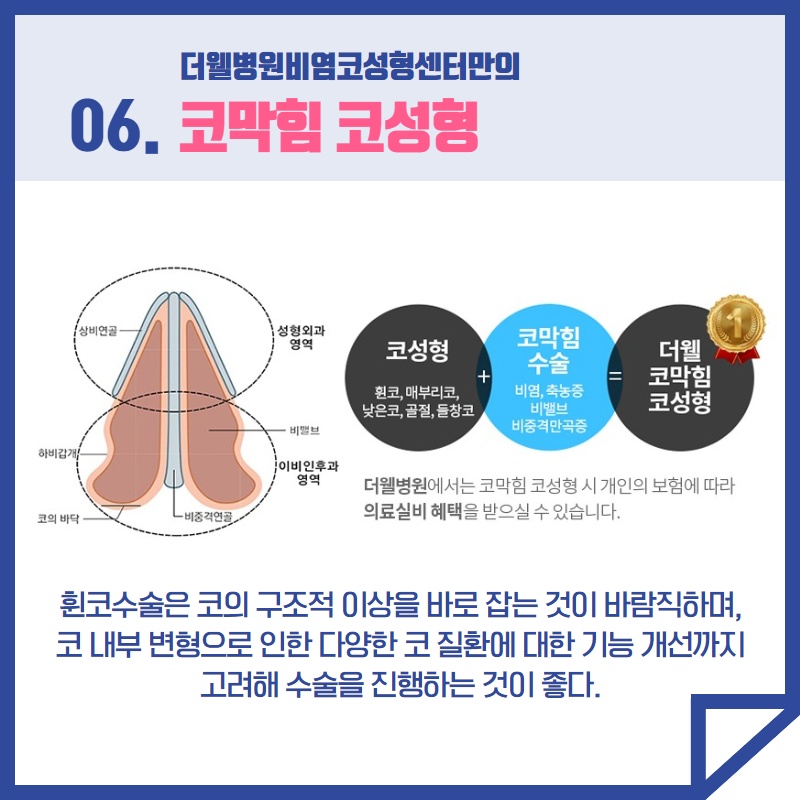 휘어진 코 성형 수술 (7/9)