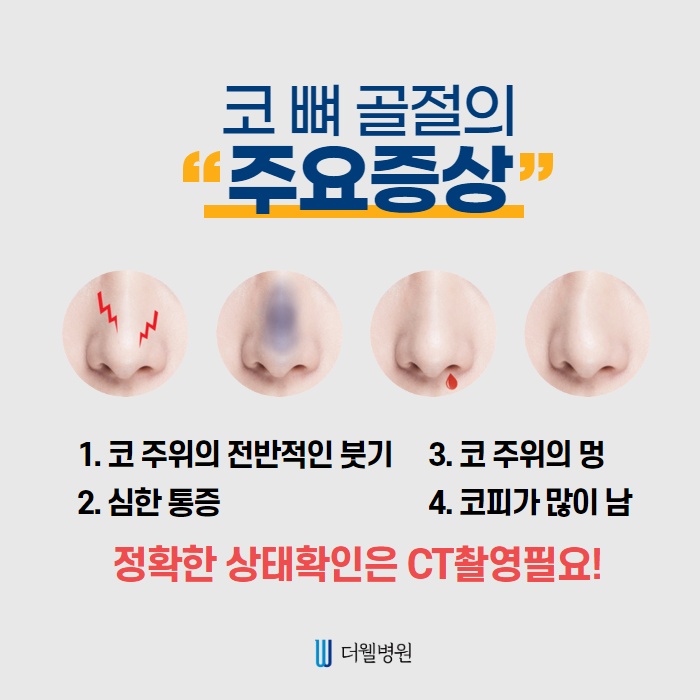 코 뼈 골절, 골든타임?! (4/10)