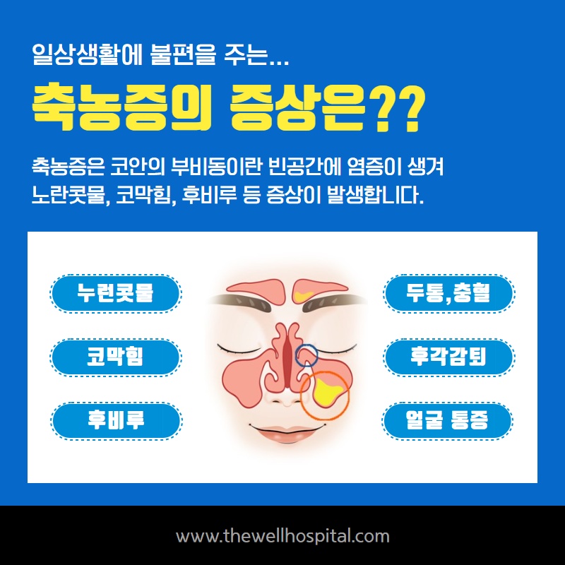 코막힘, 누런콧물 지속될때 감기일까 축농증일까? (4/12)