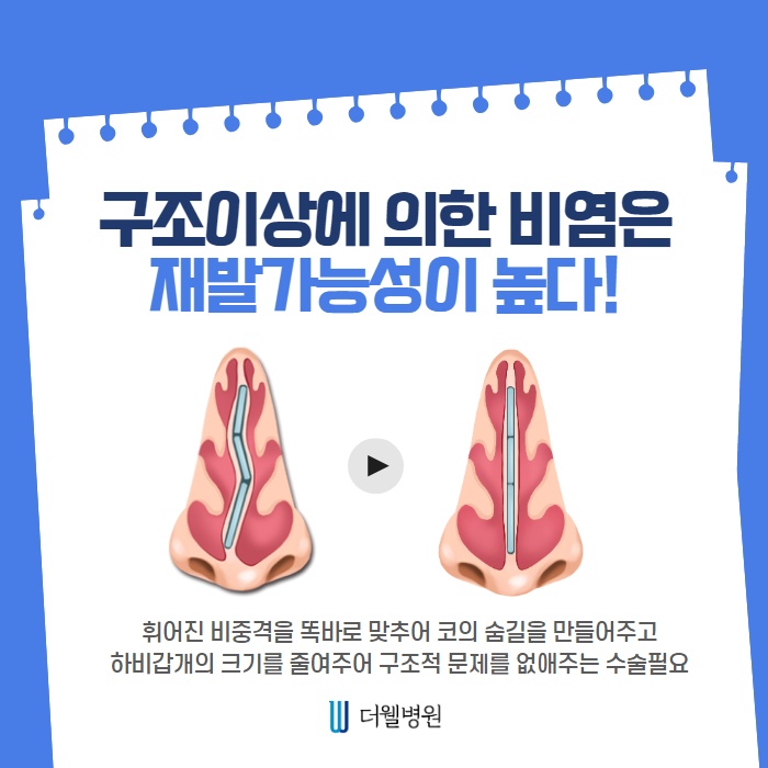환절기 비염주의보! 즉시 치료해야합니다! (5/11)