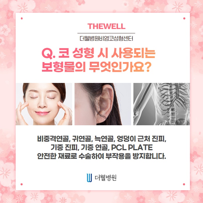 비염수술 코성형 Q&A! (5/10)