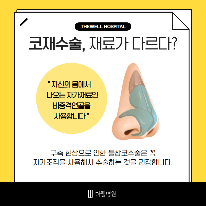 기능과 모양까지 고려한 여성 코재수술! (4/10)