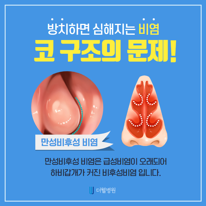 비염수술로 막힌 코를 시원하게! (4/9)