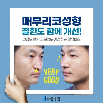 매부리코! 질환도 함께 개선하면 일석이조!