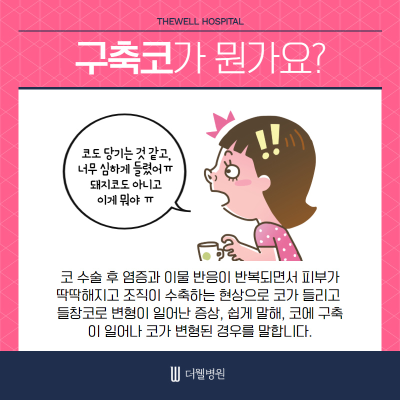 기능과 모양까지 고려해야 성공하는 여성 코재수술 (3/10)