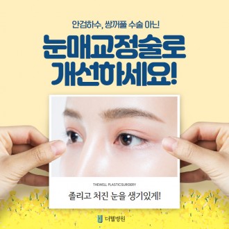 안검하수, 쌍꺼풀이 아닌 눈매교정으로 개선하세요!