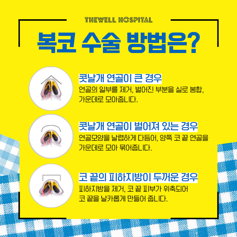 답답하고 뭉툭한 코 고민! 해결방법은? (4/10)
