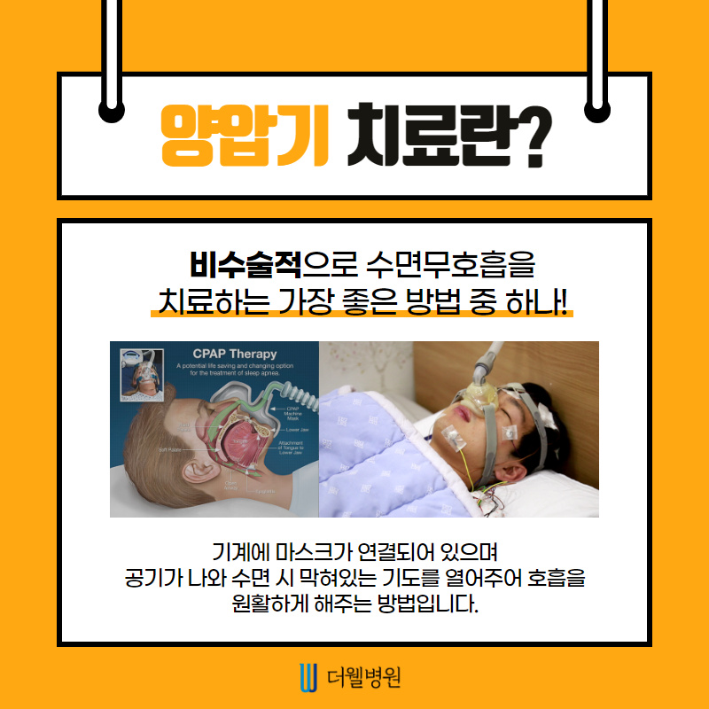 양압기, 평생 써야 하나요? (3/12)