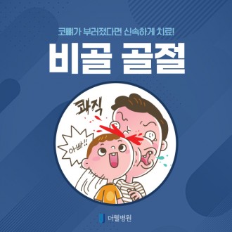 코 뼈가 부러졌다면 신속하게 치료!