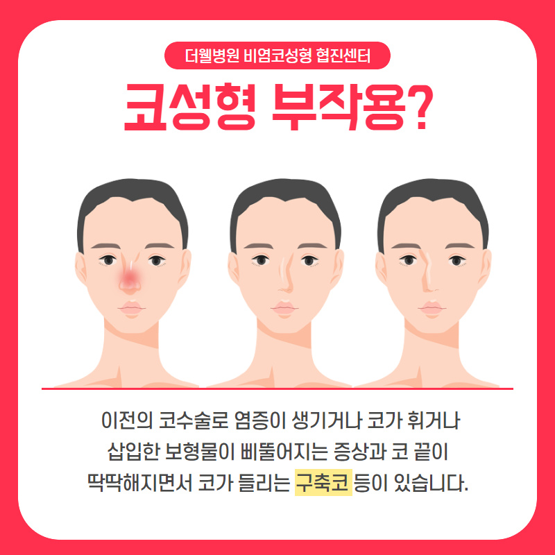 "코 재수술" 처음보다 더 꼼꼼하게 따져봐야해요! (2/10)