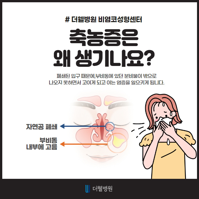 콧물, 코막힘, 축농증! 시원하게 탈출! (2/9)