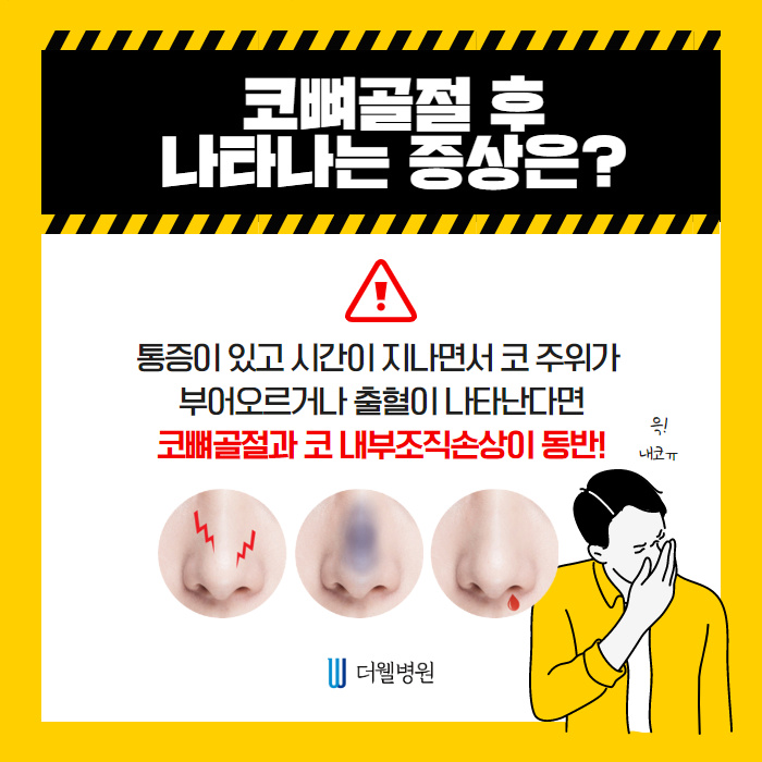 코뼈골절 수술! 휜코, 코막힘 해결! (2/11)