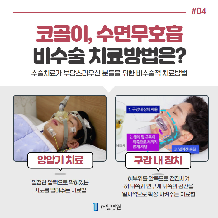 헐; 코골이가 질병이라구? (5/10)