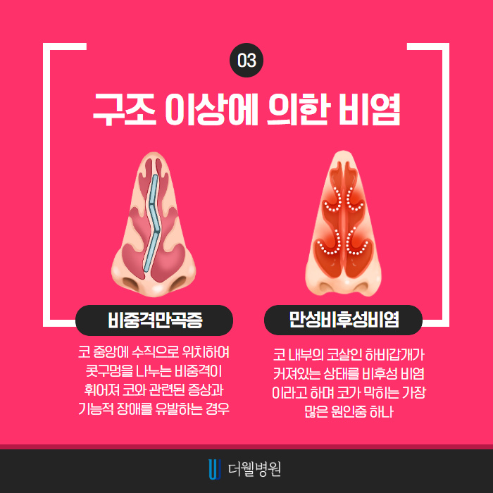 눈/코 긁적, 콧물 줄줄.. 코감기 아닌 알레르기 비염! (4/9)