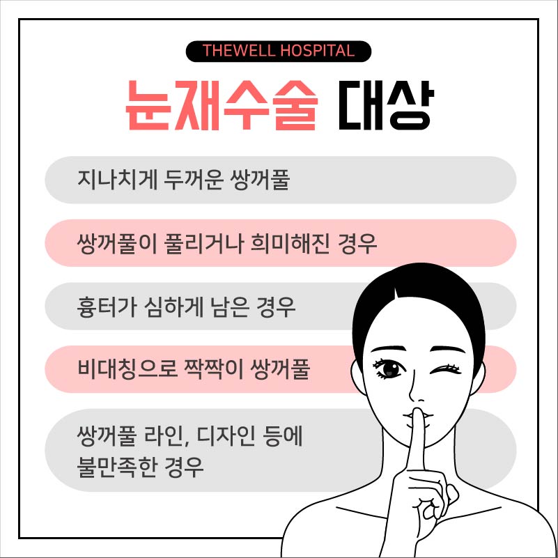 눈 재수술, 더 신중하게 결정하세요! (3/10)