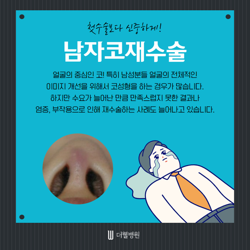 두번의 실패는 없다! 남자코재수술! (2/10)