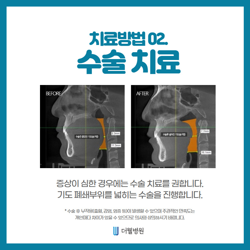 잠자는 숲속의 코골이 공주 (8/13)