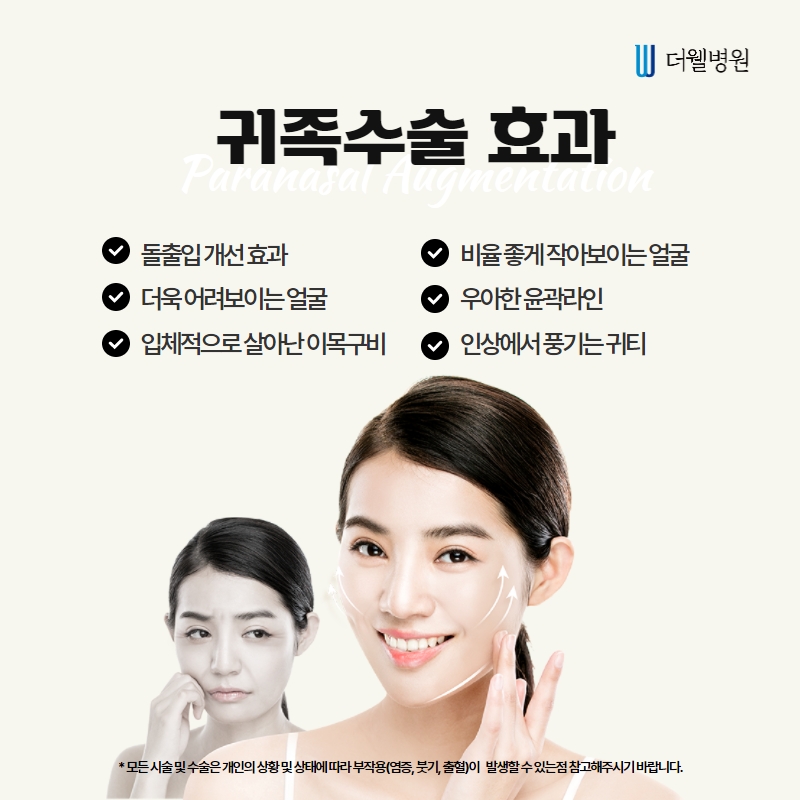 더웰병원 귀족수술