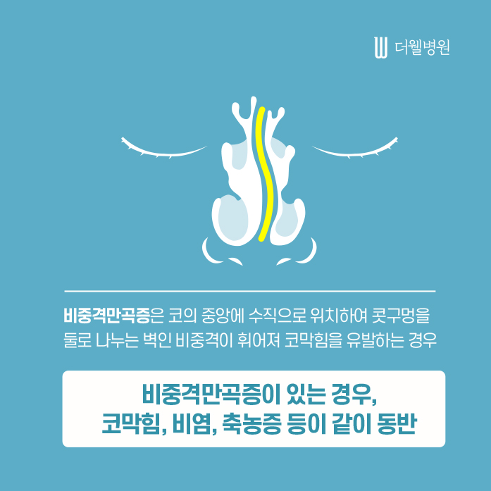 더웰병원 비중격만곡증 수술