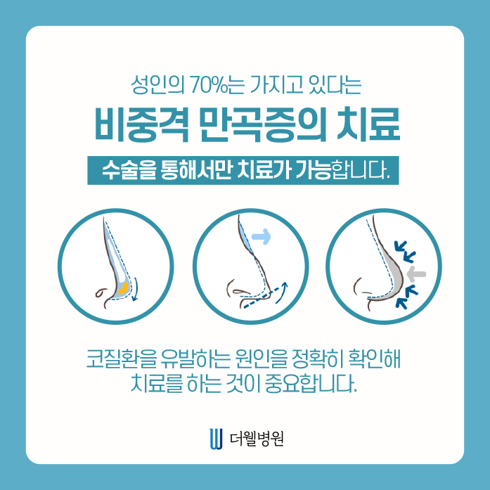 더웰병원 비중격만곡증 수술