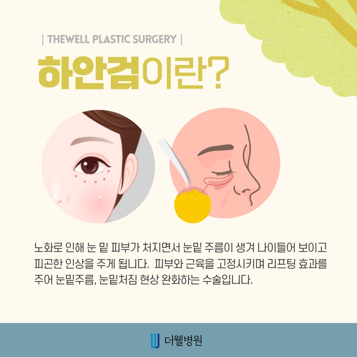 더웰병원 상안검 수술
