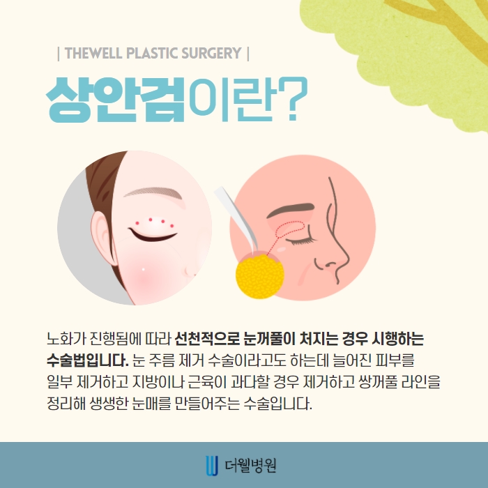 더웰병원 상안검 수술