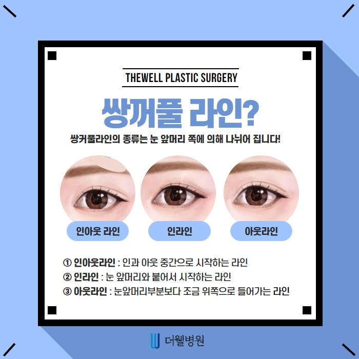 더웰병원 쌍커풀 절개법