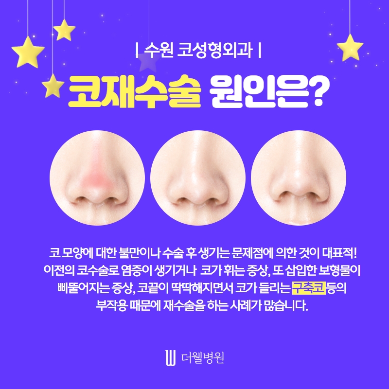 더웰병원 코 재수술