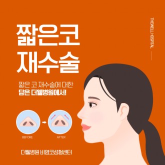 짧은 코 재수술