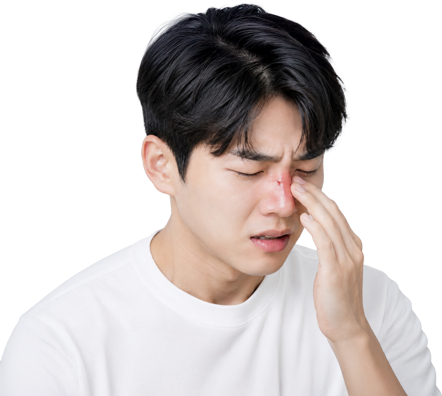 더웰병원 코뼈골절 수술